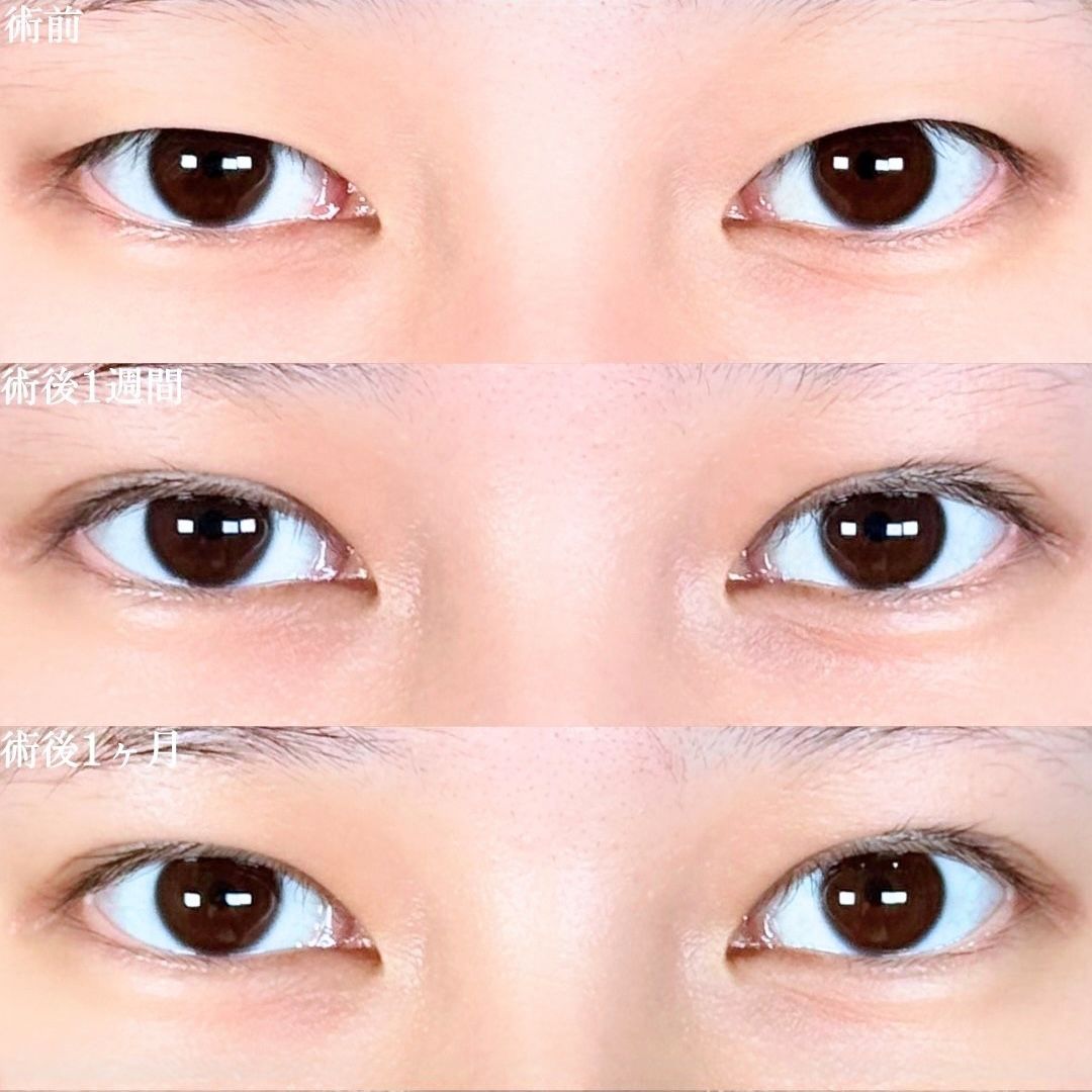 No.17610の症例写真 No.17610の症例写真