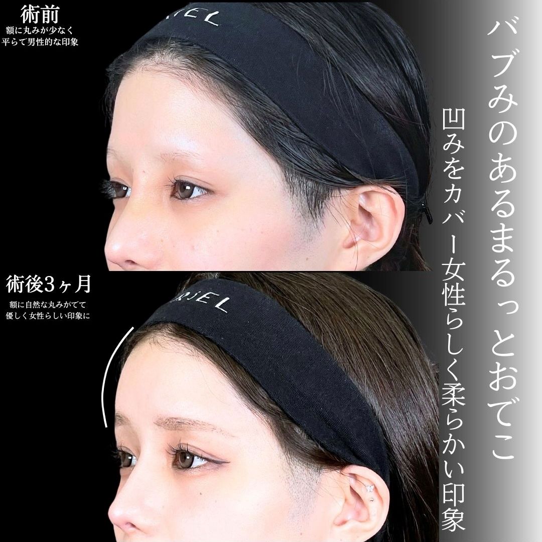 No.17703の症例写真1