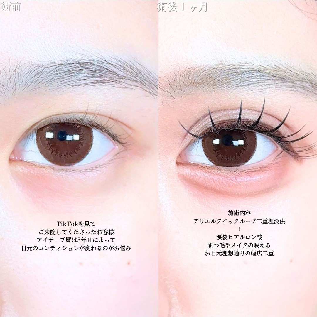 No.17731の症例写真1