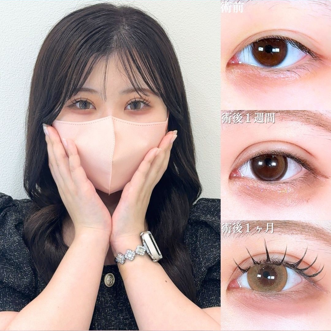 No.17738の症例写真