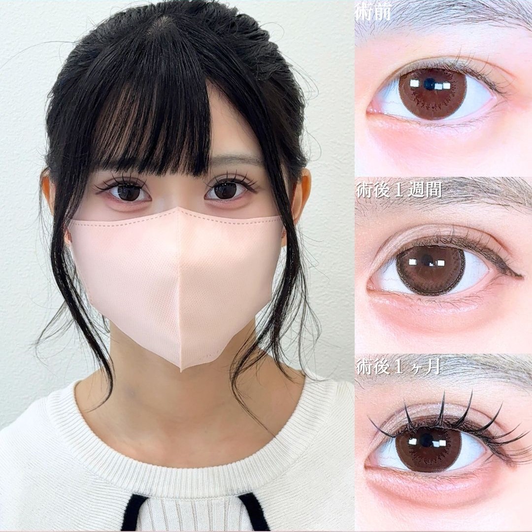 No.17731の症例写真