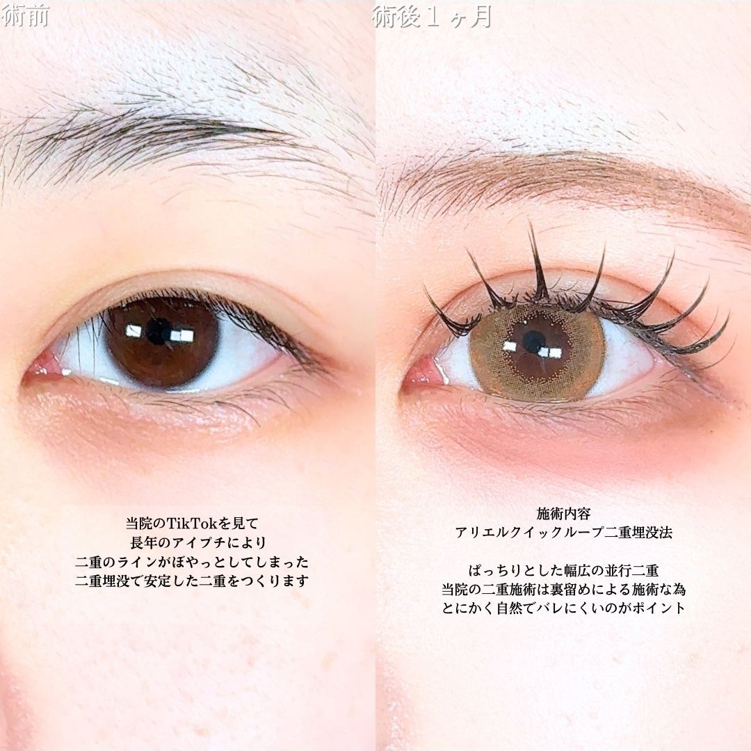 No.17738の症例写真1