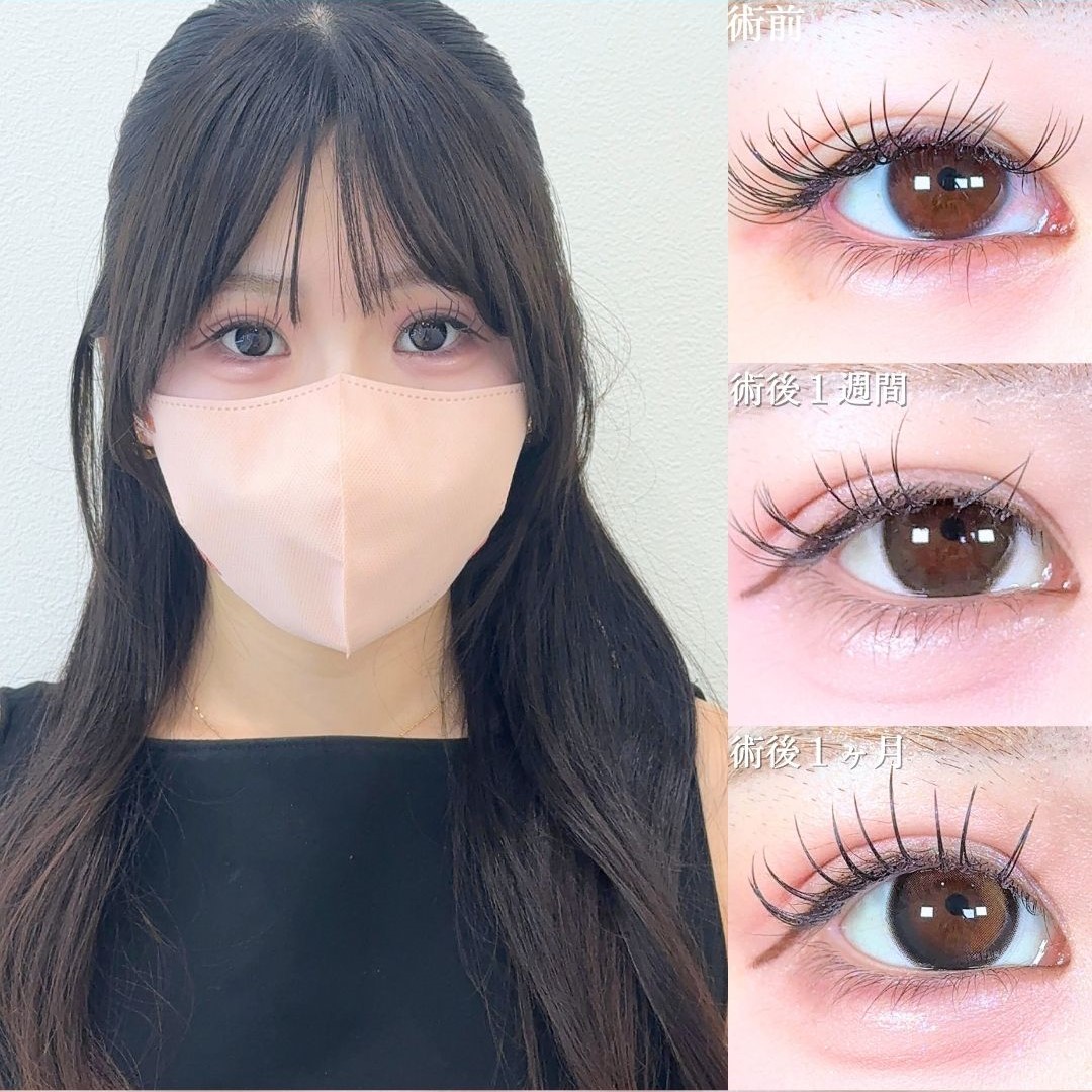 No.17671の症例写真 No.17671の症例写真