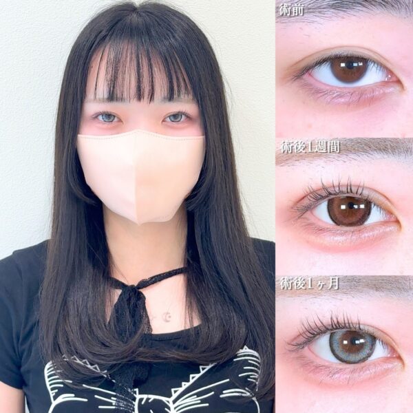 No.17622の症例写真