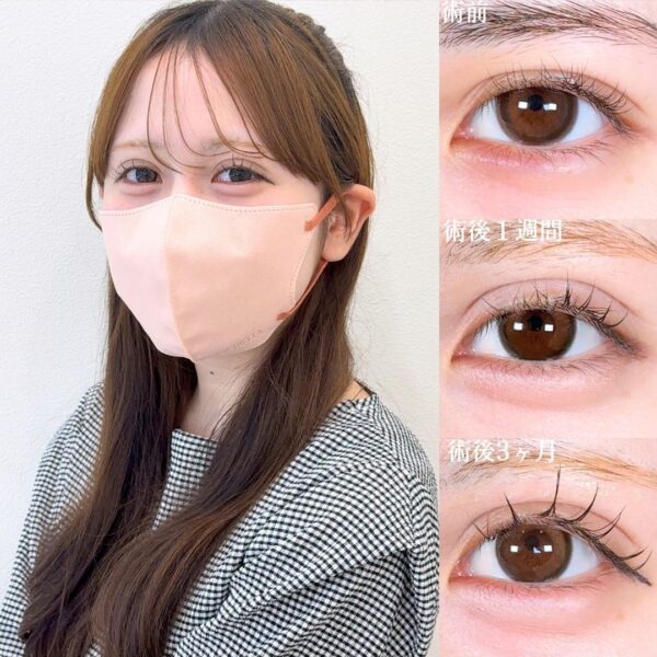 No.17709の症例写真