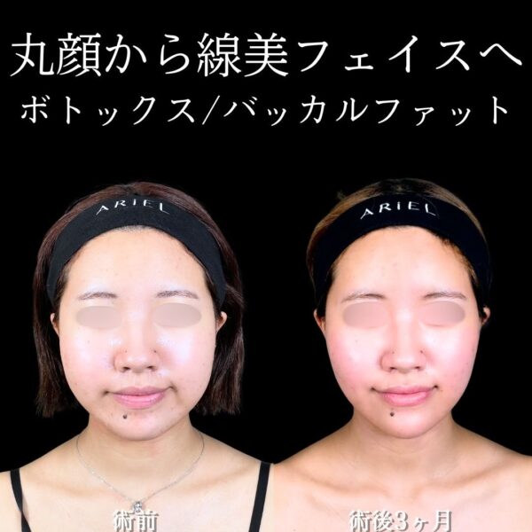 No.17664の症例写真