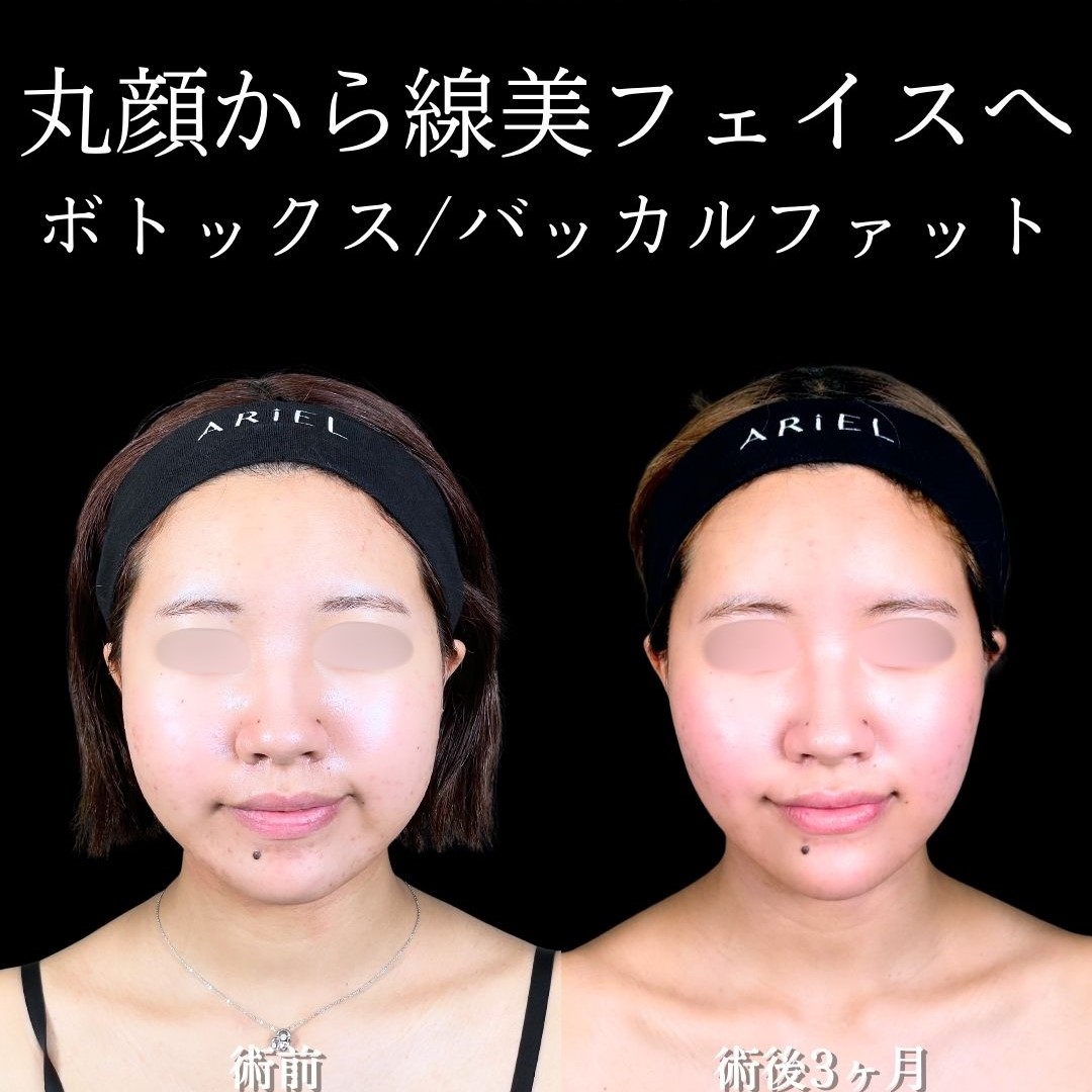 No.17664の症例写真 No.17664の症例写真