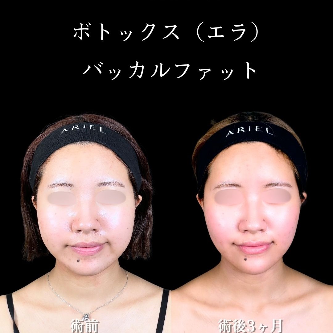 No.17664の症例写真2