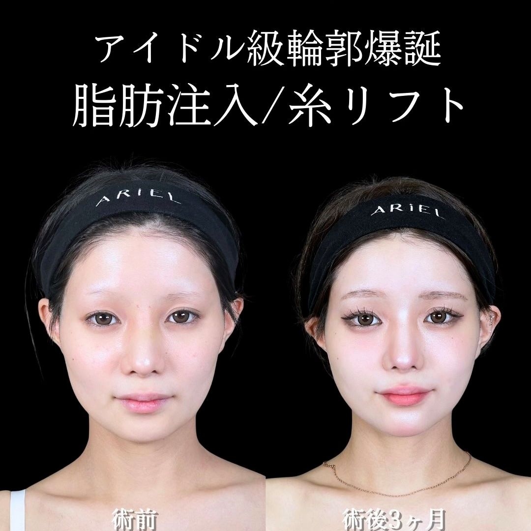 No.17703の症例写真