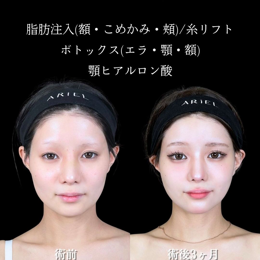No.17703の症例写真2
