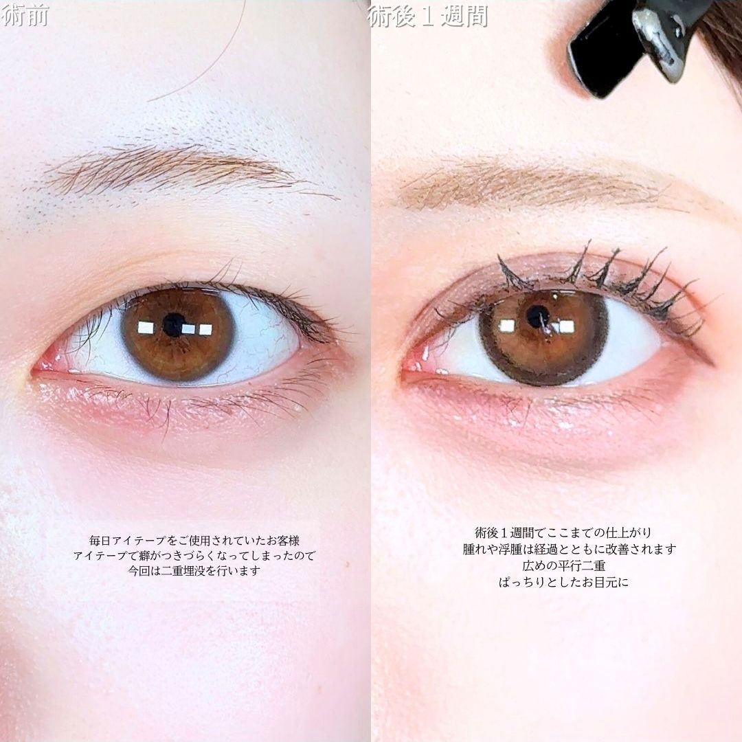 No.17618の症例写真1
