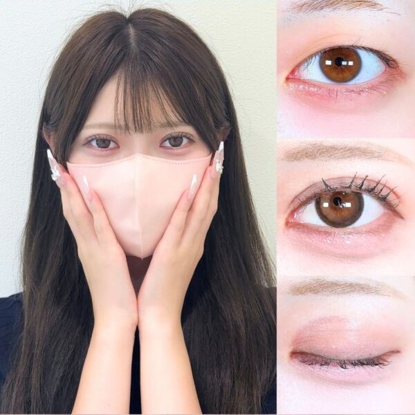 No.17618の症例写真