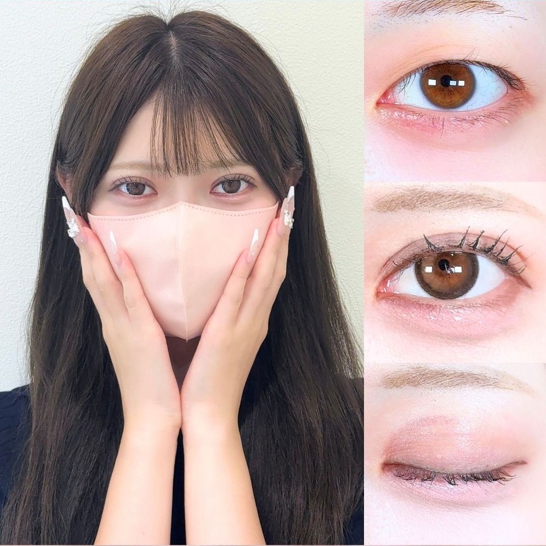 No.17618の症例写真 No.17618の症例写真