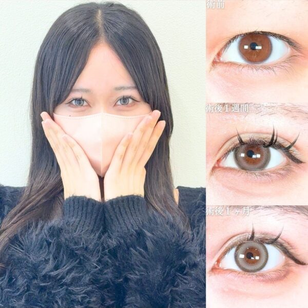 No.17832の症例写真