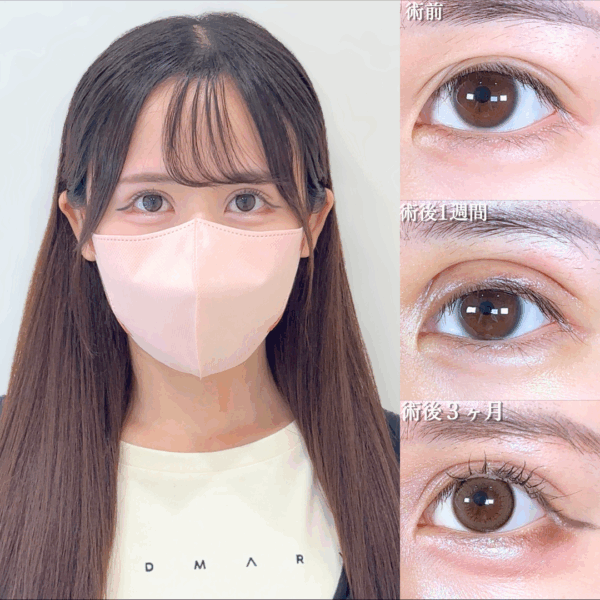 No.17930の症例写真