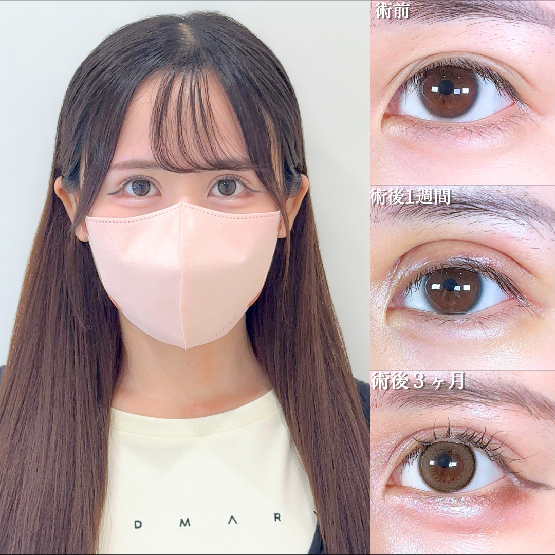 No.17930の症例写真 No.17930の症例写真