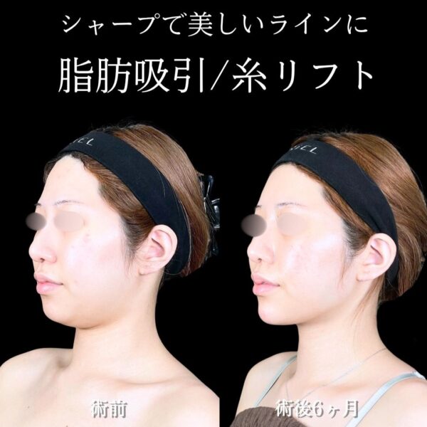 No.17994の症例写真
