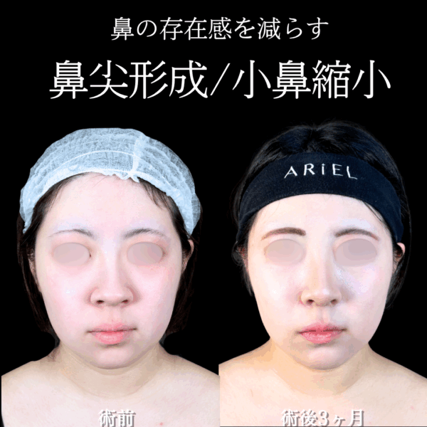 No.17936の症例写真