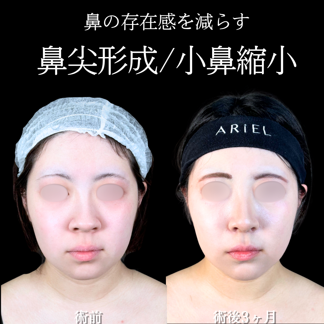 No.17936の症例写真
