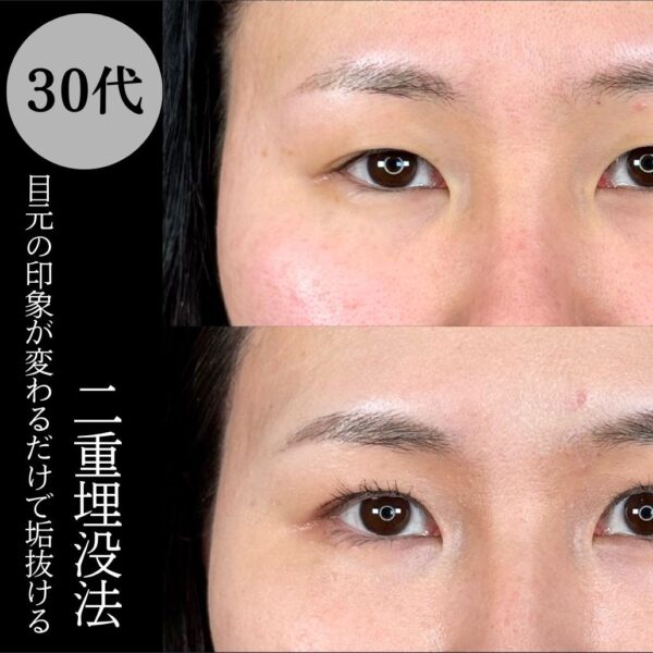 No.18019の症例写真
