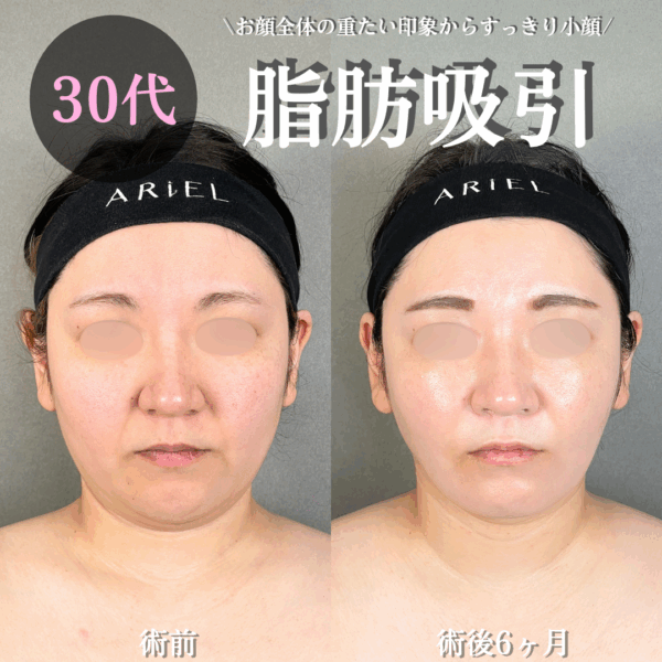 No.18097の症例写真