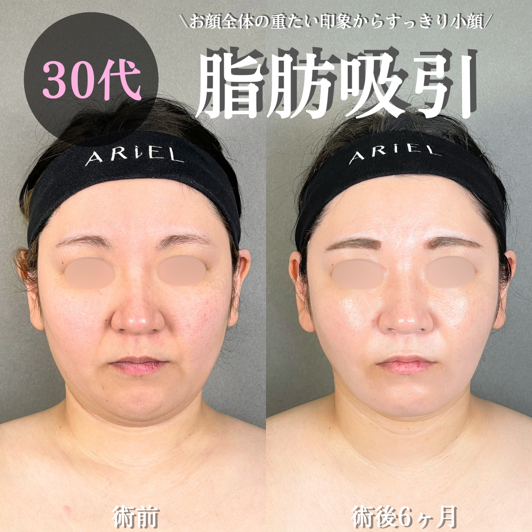 No.18097の症例写真 No.18097の症例写真