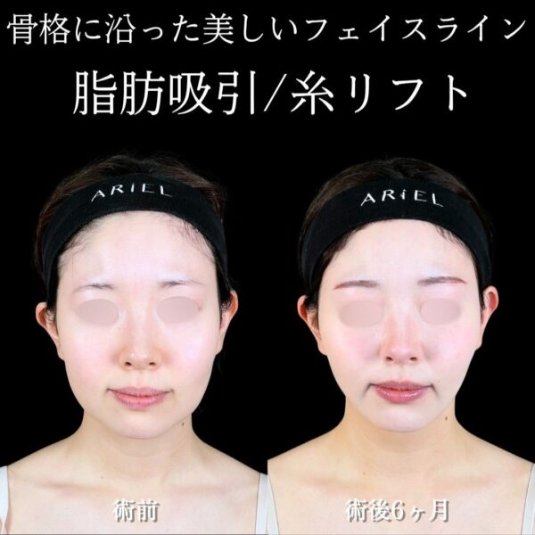 No.18045の症例写真