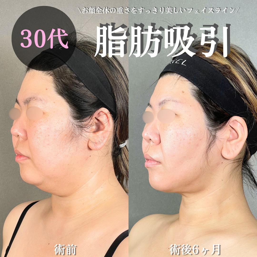 No.18229の症例写真 No.18229の症例写真