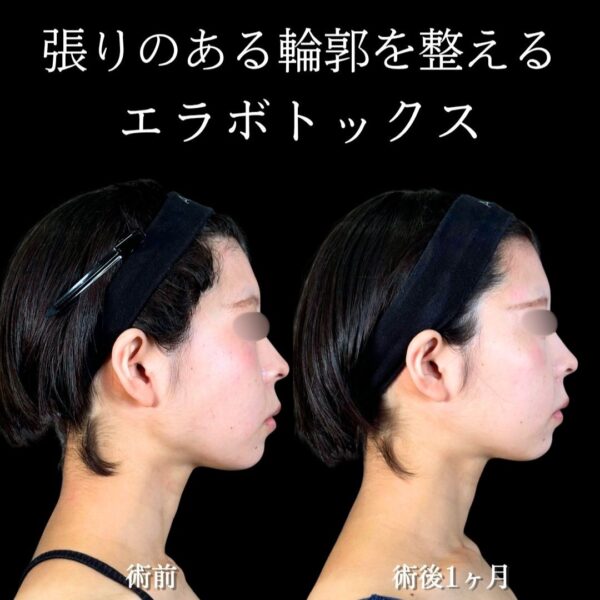 No.18079の症例写真