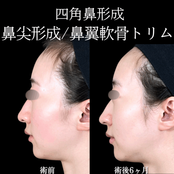 No.18304の症例写真