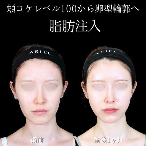 No.18089の症例写真