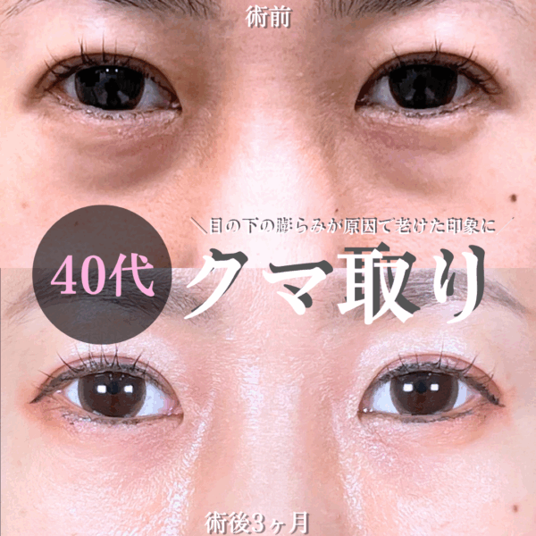 No.18429の症例写真 No.18429の症例写真