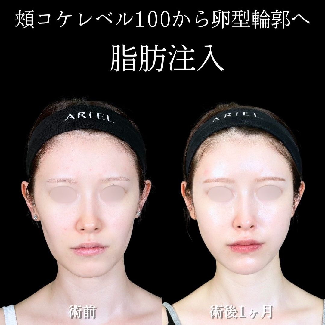 No.18089の症例写真 No.18089の症例写真