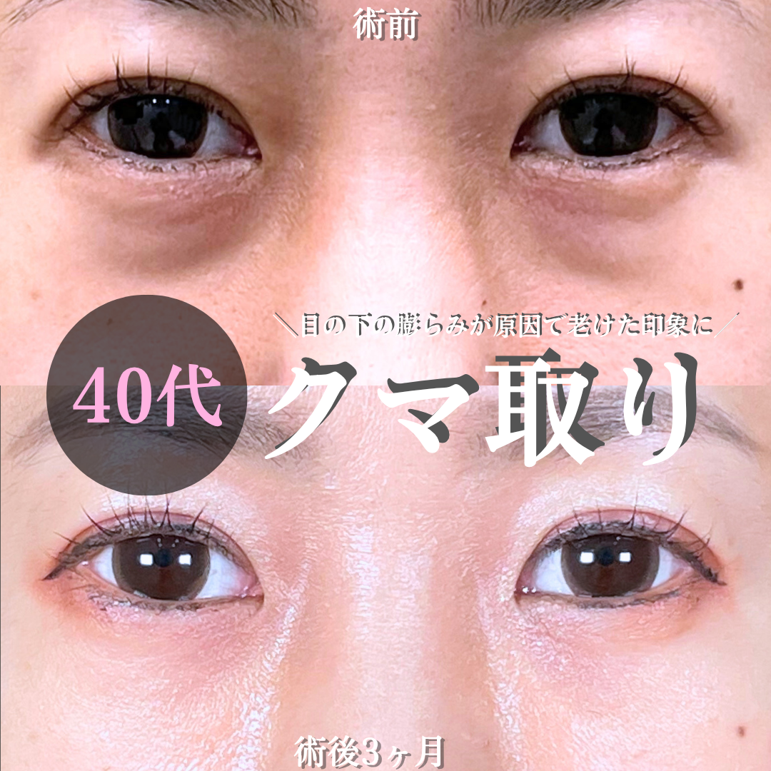 No.18429の症例写真 No.18429の症例写真