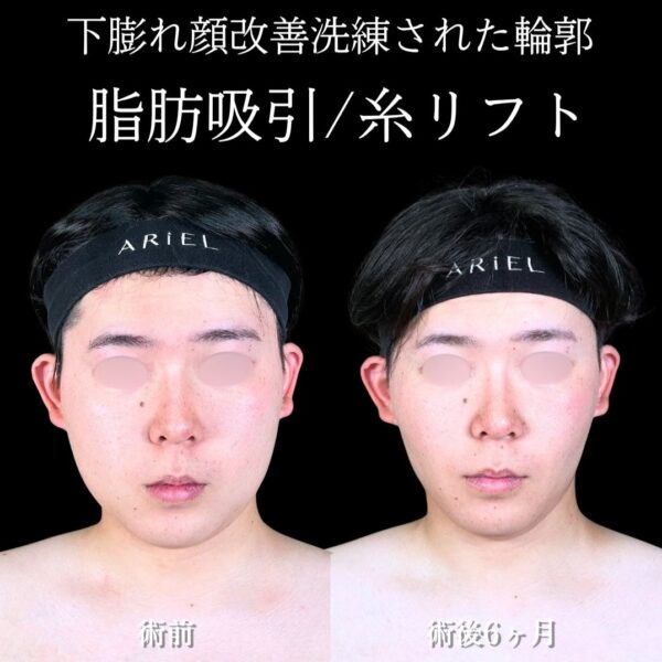 No.17833の症例写真
