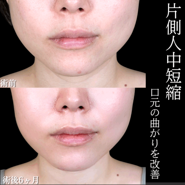 No.17918の症例写真