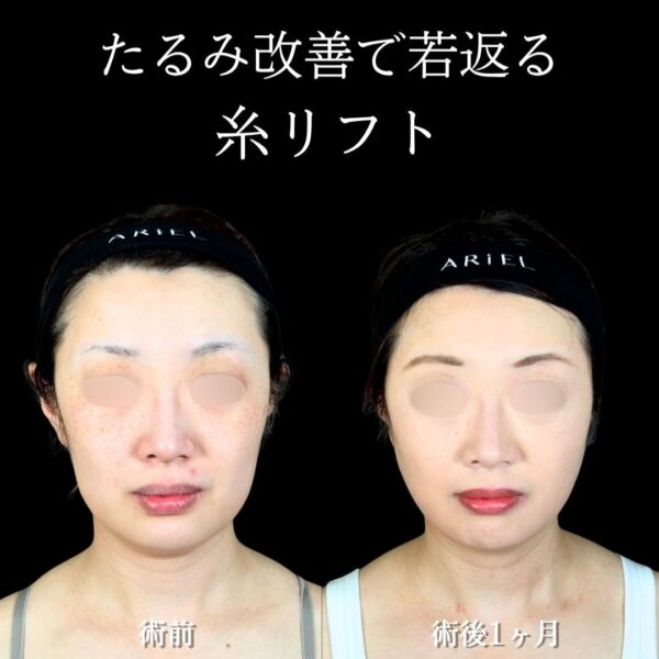 No.18143の症例写真