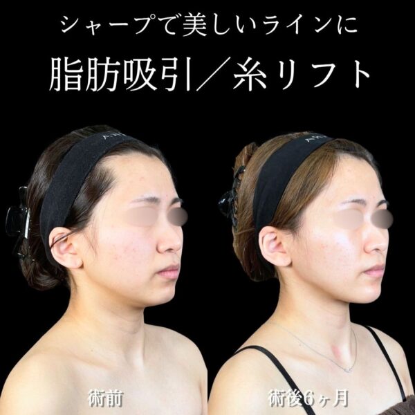 No.18163の症例写真