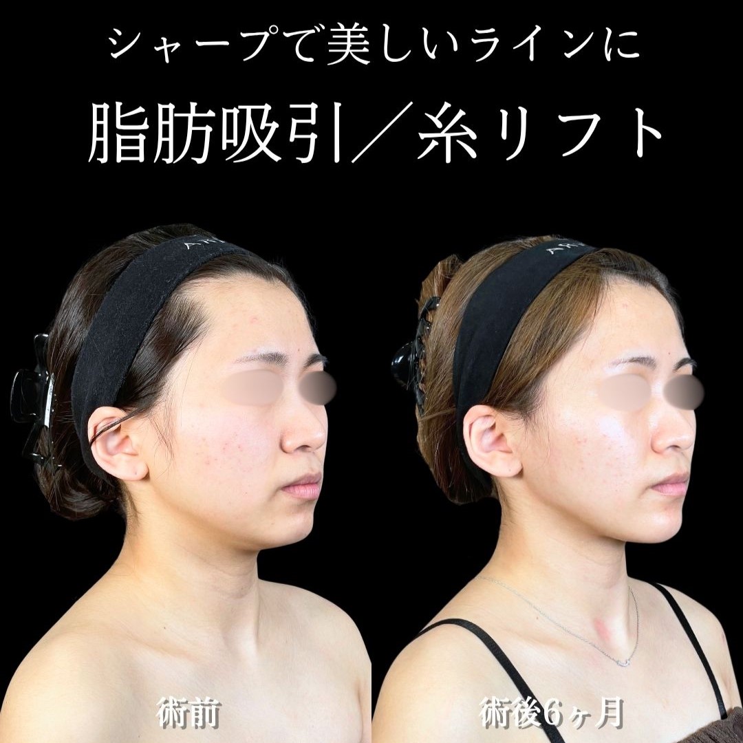 No.18163の症例写真