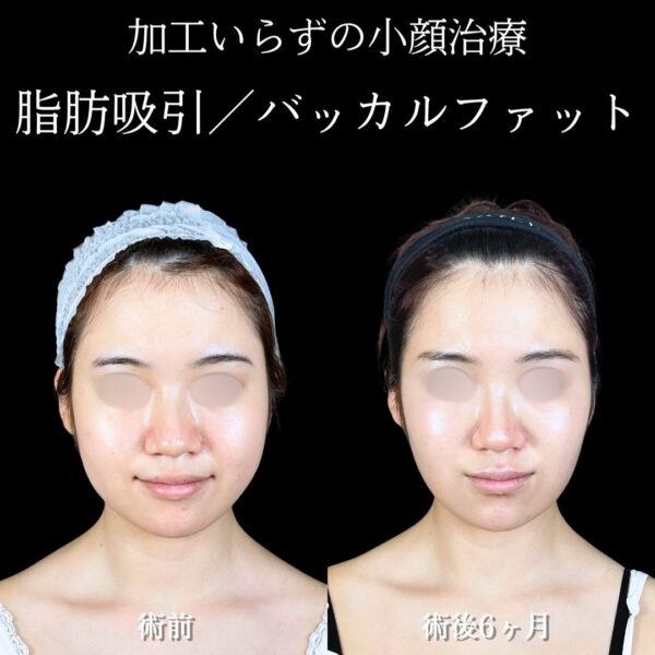 No.18210の症例写真