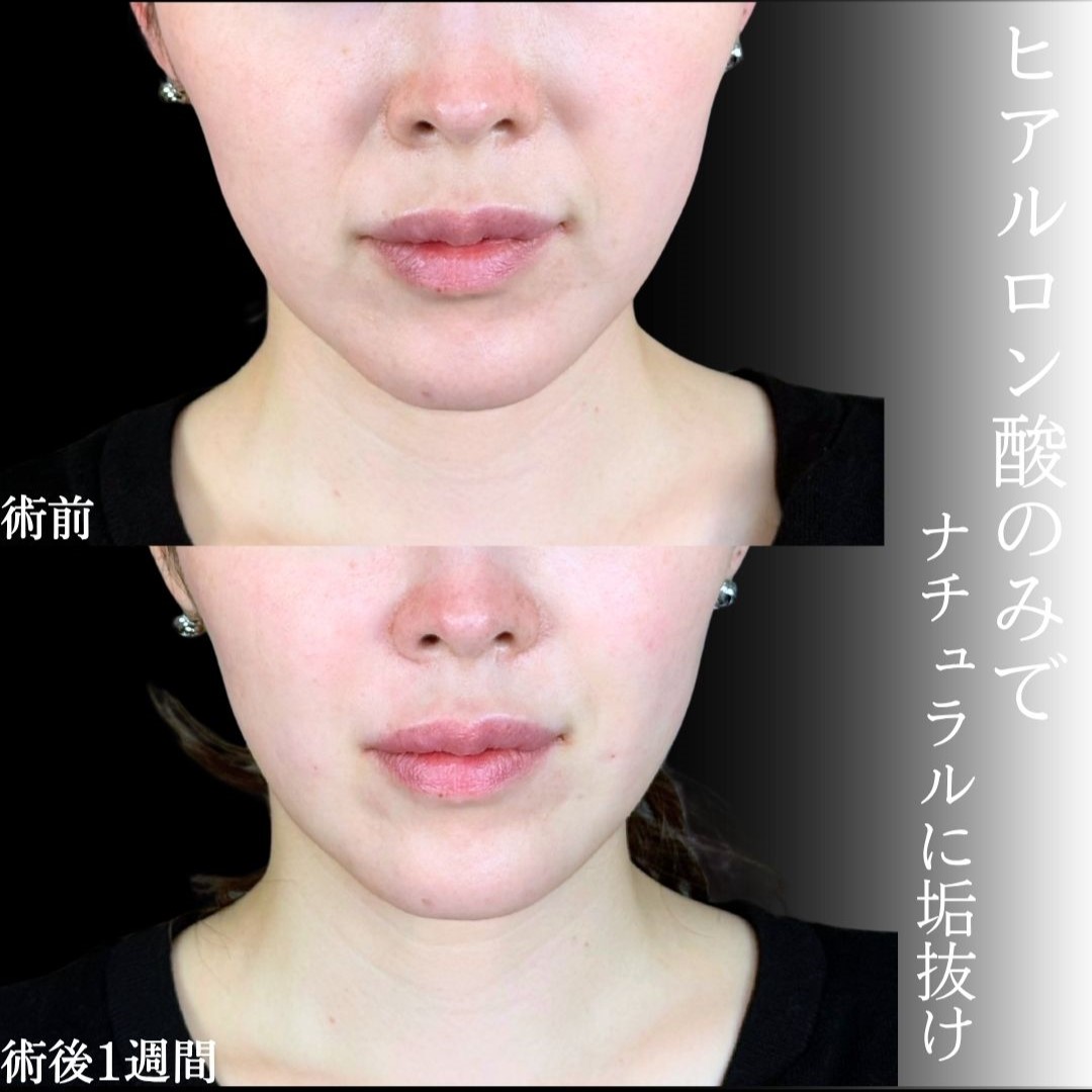 No.18291の症例写真1 No.18291の症例写真1