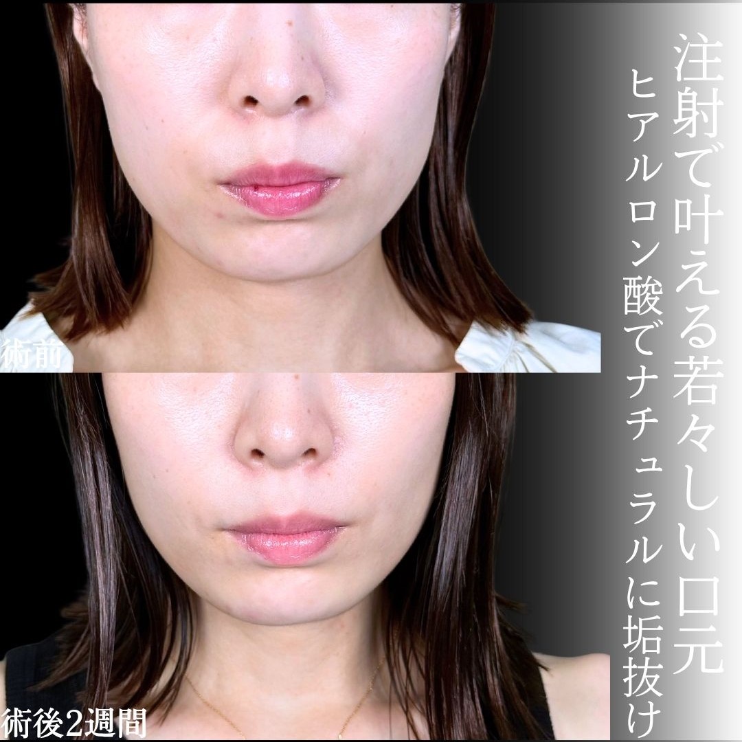 No.18199の症例写真1