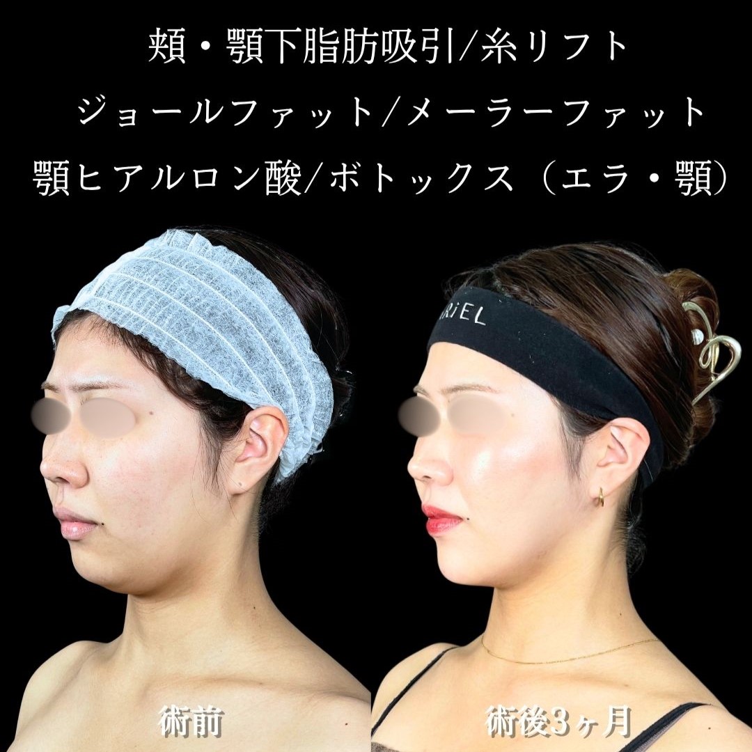 No.18330の症例写真2 No.18330の症例写真2