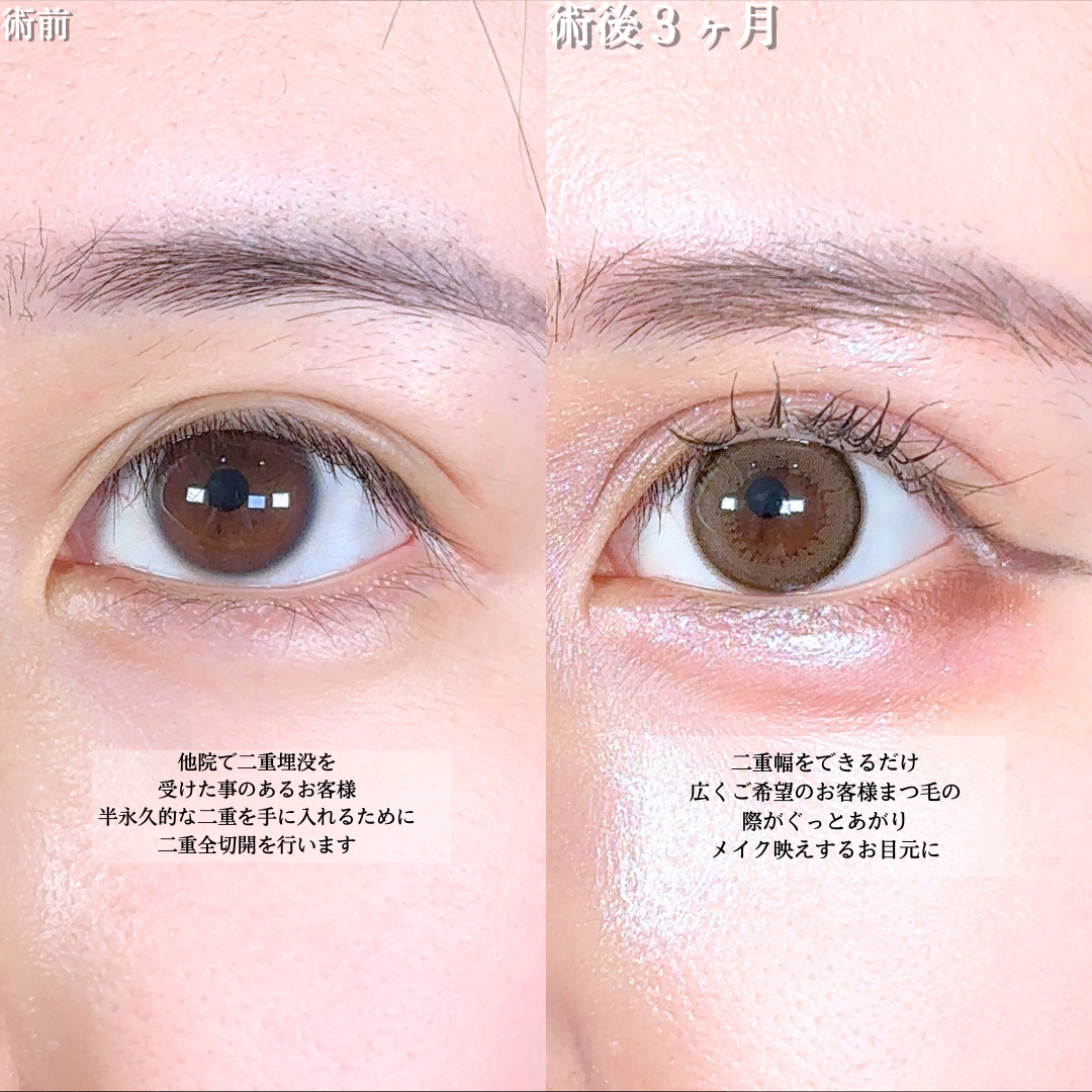 No.17930の症例写真1