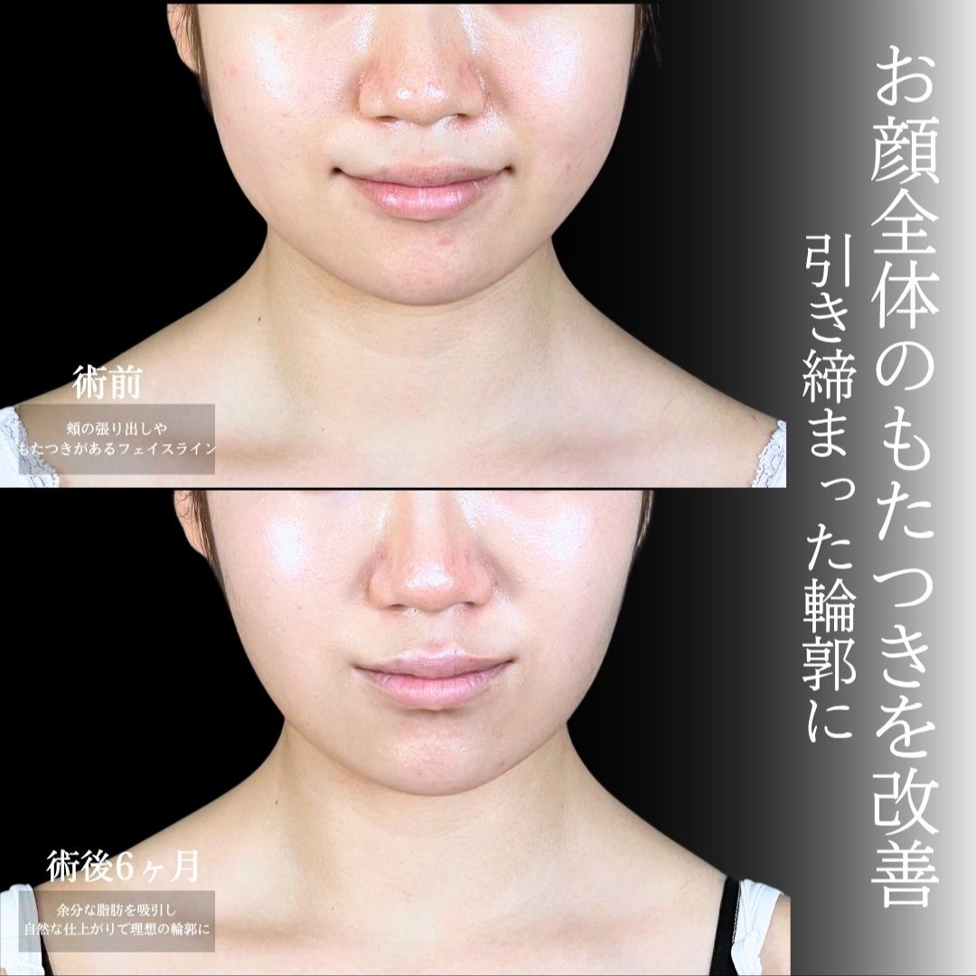 No.18210の症例写真1