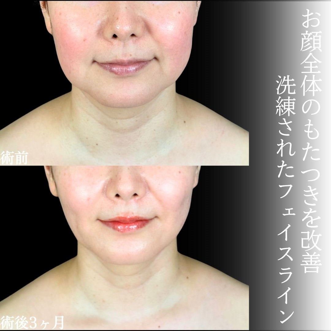 No.18414の症例写真1