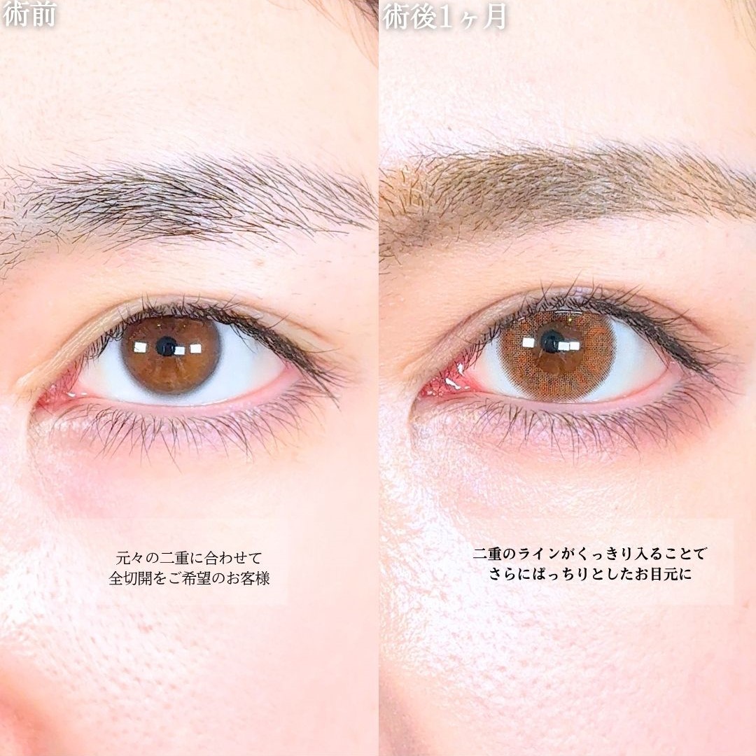 No.18447の症例写真1