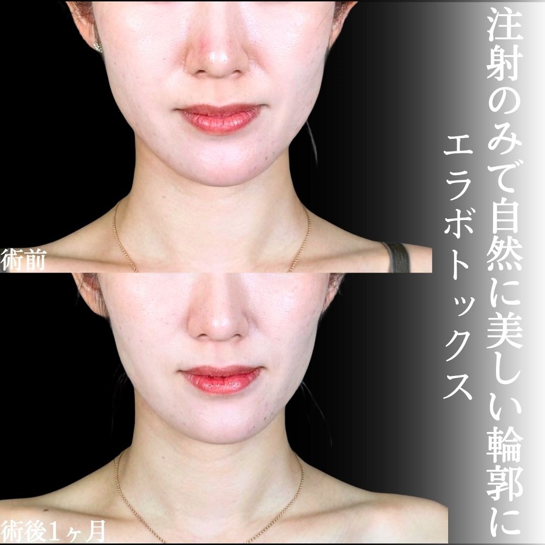 No.17972の症例写真1