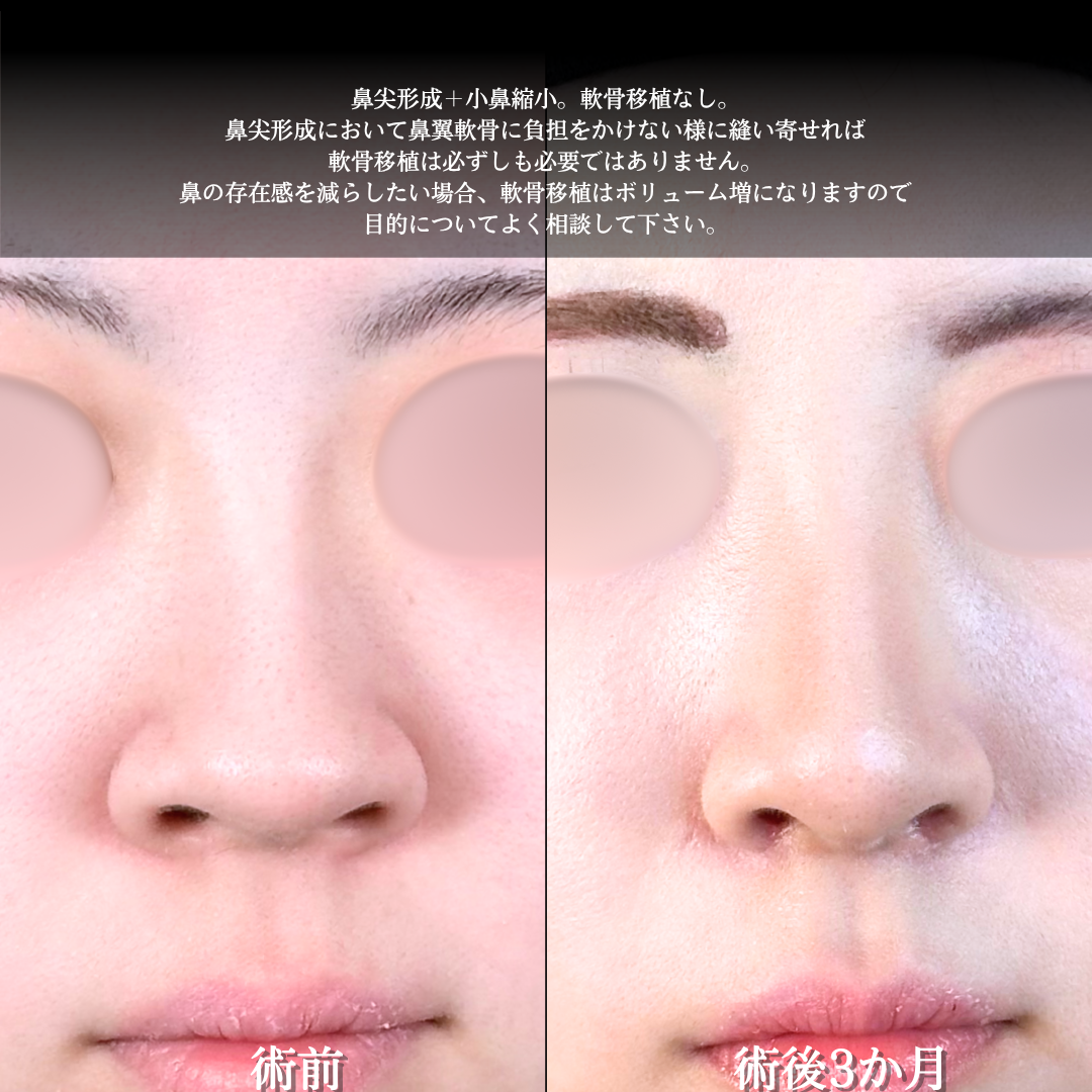 No.17936の症例写真1