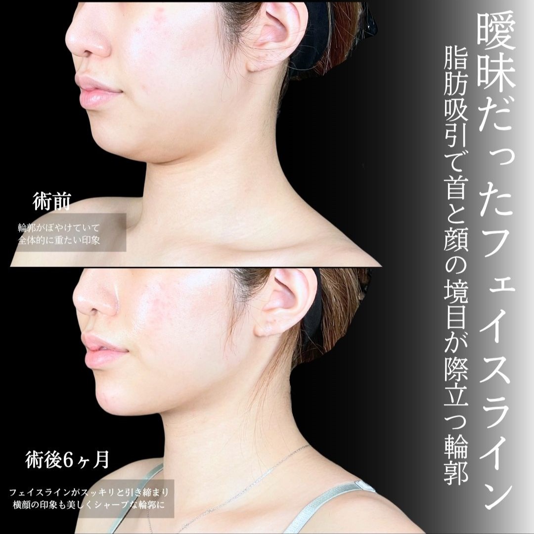 No.17994の症例写真1